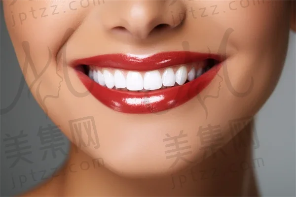 河南牙齿美白费用是多少？2025年牙齿美白价格大揭秘，附带氟斑牙治疗费用参考。