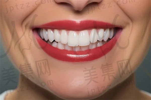 补牙是否归属于口腔修复科？探讨补牙与口腔修复科的关系