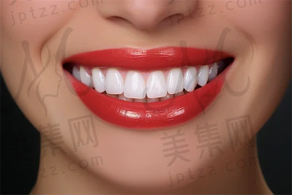 探索石家庄精良口腔门诊的牙齿美白服务：开启自信微笑的转变之旅，感受焕然一新的魅力体验。
