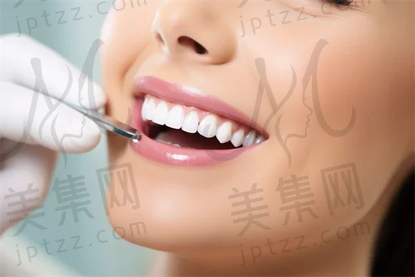 南昌牙齿美白费用是多少？2025年牙齿美白价格全解析，顺便提及氟斑牙治疗的价格信息。