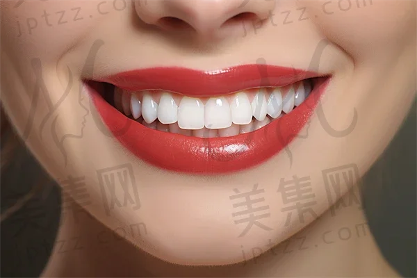 温州活动义齿费用是多少？2025年活动义齿价格一览，特别提及BPS全口吸附义齿的价格信息。