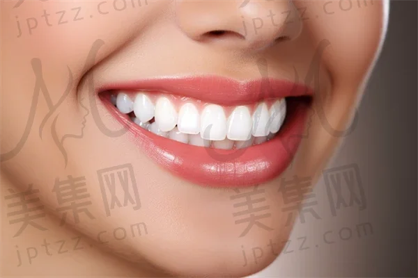 绵阳牙齿美白费用是多少？2025年牙齿美白价格表详解，特别关注皓齿美白的收费情况。