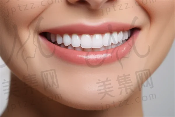 德州活动义齿费用是多少？2025年活动义齿价格表发布，特别关注活动义齿的费用及胶托局部活动义齿价格。
