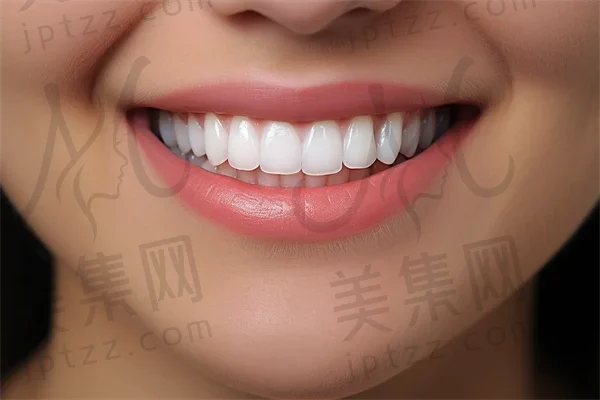 淮安牙齿矫正费用是多少？2025年牙齿矫正价格详解，特别提及spark隐形矫正的费用情况。
