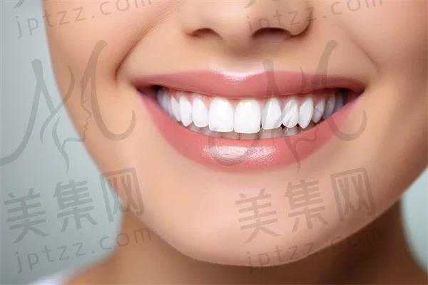 石家庄牙齿美白费用揭秘！2025年牙齿美白价格表曝光，激光美白价格也一并透露，快来了解多少钱！