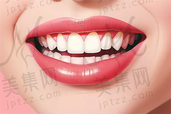 宁德牙齿矫正费用大揭秘：2025年牙齿矫正多少钱？陶瓷自锁托槽矫正价格也一并揭晓！