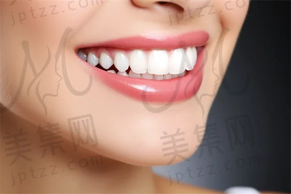 宁波牙齿美白费用揭秘：2025年牙齿美白价格表及洁牙费用一览，多少钱更具参考价值！