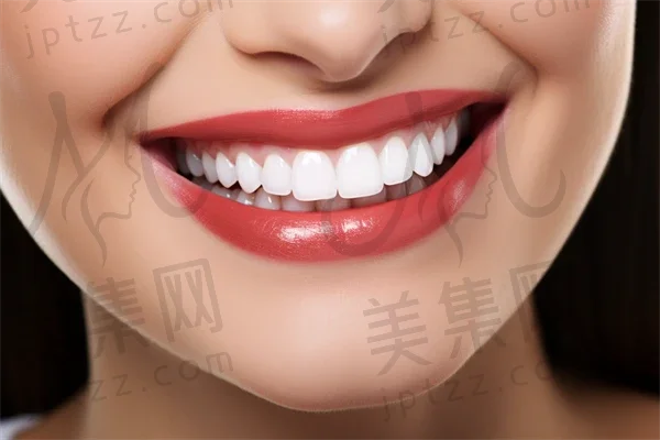 在宁波鄞州益贝口腔门诊部的种植牙体验：专業团队与杰出结果的良好融合，让我倍感满意。