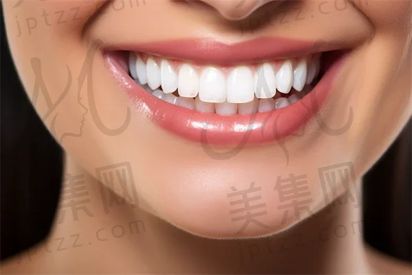 如何快速有效地让牙齿美白？探索牙齿美白的很不错方法与技巧。