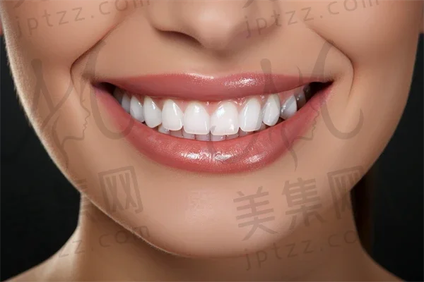 长春牙齿美白费用揭秘：2025年牙齿美白多少钱？附带洁牙价格简析，让你齐全了解口腔护理开支。