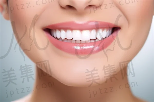 西安碑林美奥口腔门诊部牙齿美白体验回顾：重塑我的笑容，焕发自信与魅力！