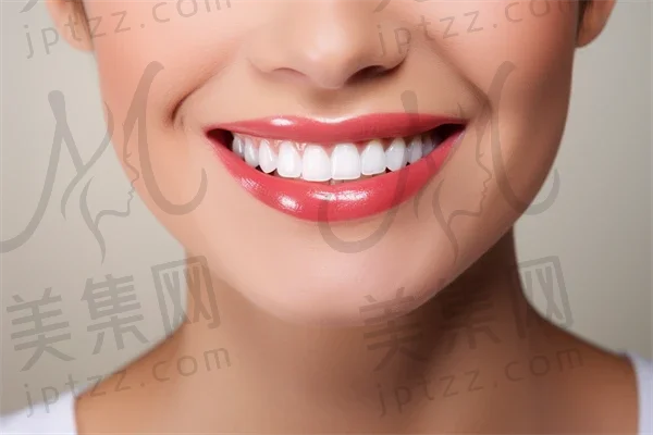 宜昌牙齿美白费用是多少？2025年牙齿美白价格一览，特别关注皓齿美白的费用详情。
