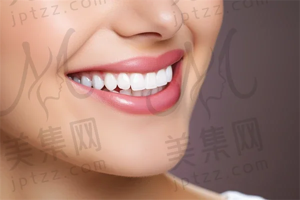 昆明牙齿美白费用是多少？2025年牙齿美白价格齐全解析，特别关注皓齿美白的价格信息。