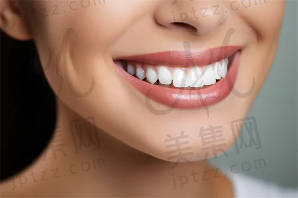 临沂牙齿美白费用是多少？2025年牙齿美白价格一览，附带四环素牙的价格信息。
