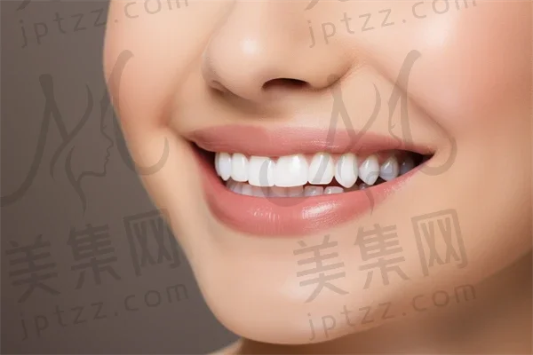 2025年杭州活动义齿费用揭秘！多少钱才能拥有优质活动义齿？同时了解BPS全口吸附义齿的价格。