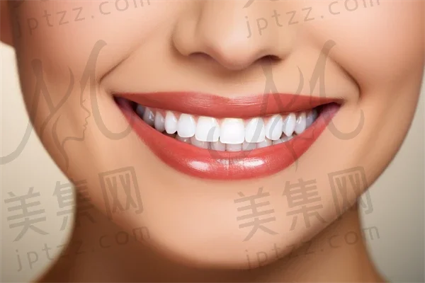 潍坊牙齿矫正费用揭秘：2025年新牙齿矫正价格表，了解多少钱及凸嘴矫正的相关费用。