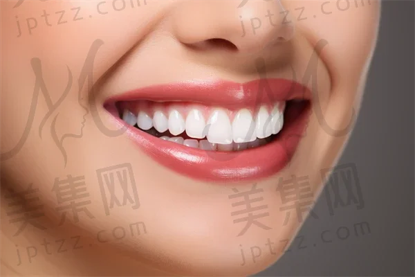 遵义活动义齿费用是多少？2025活动义齿价格表揭晓，重点关注活动义齿的费用，同时简要提及隐形义齿的价格。