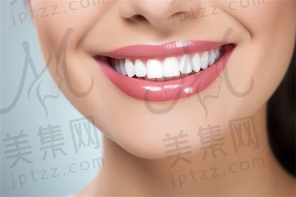 如何使用哪些方法可以有效美白牙齿？